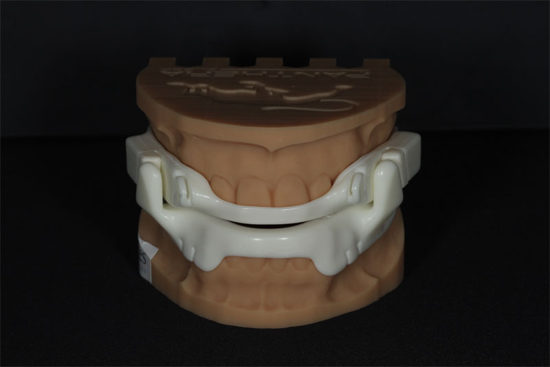 Sharp Dentistry | Bone Grafting, Dental Cleanings and Fluoride Treatment