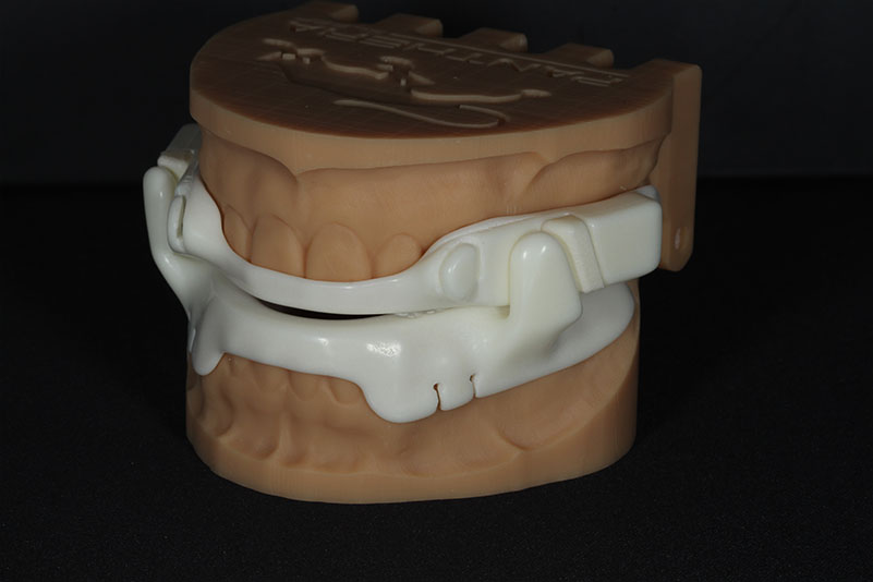 Sharp Dentistry | Periodontal Treatment, Preventative Program and Dental Sealants