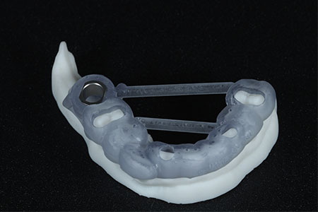 Sharp Dentistry | Sedation Dentistry, CBCT and Fluoride Treatment