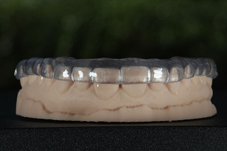 Sharp Dentistry | Digital Radiography, Intraoral Camera and Bone Grafting