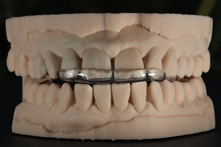 Sharp Dentistry | Periodontal Treatment, Sports Mouthguards and Dental Sealants