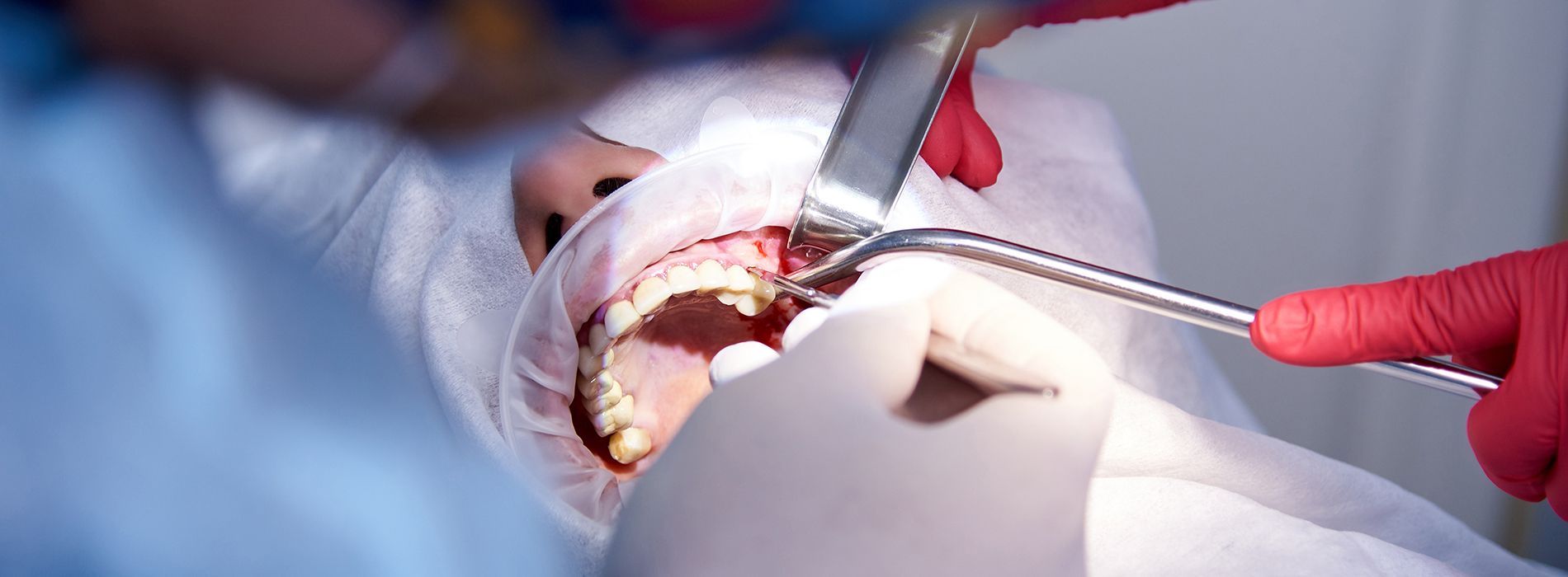 Sharp Dentistry | Implant Dentistry, Full Mouth Reconstruction and TMJ Disorders