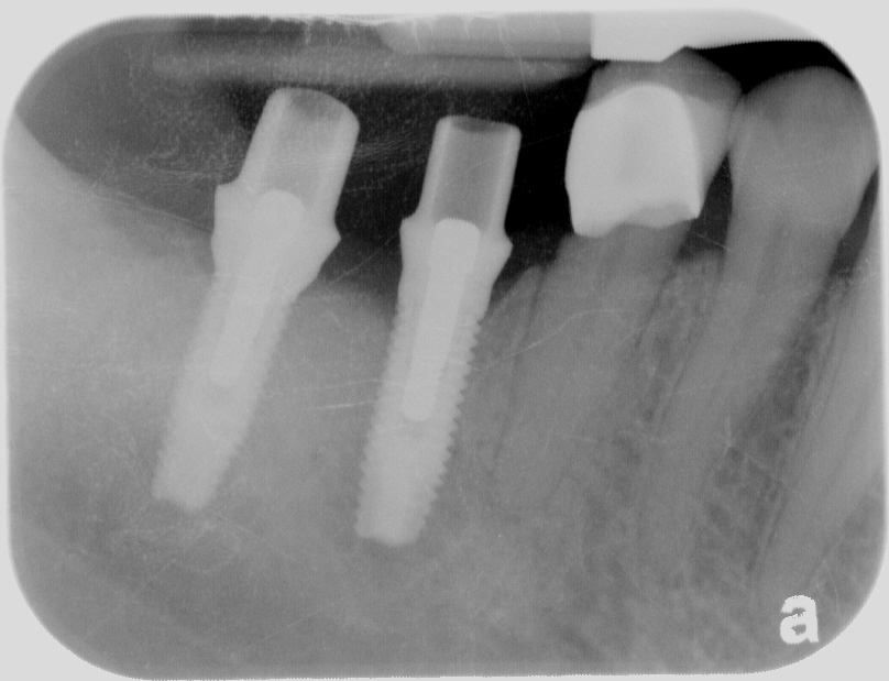 Sharp Dentistry | Oral Cancer Screening, Sedation Dentistry and Implant Dentistry