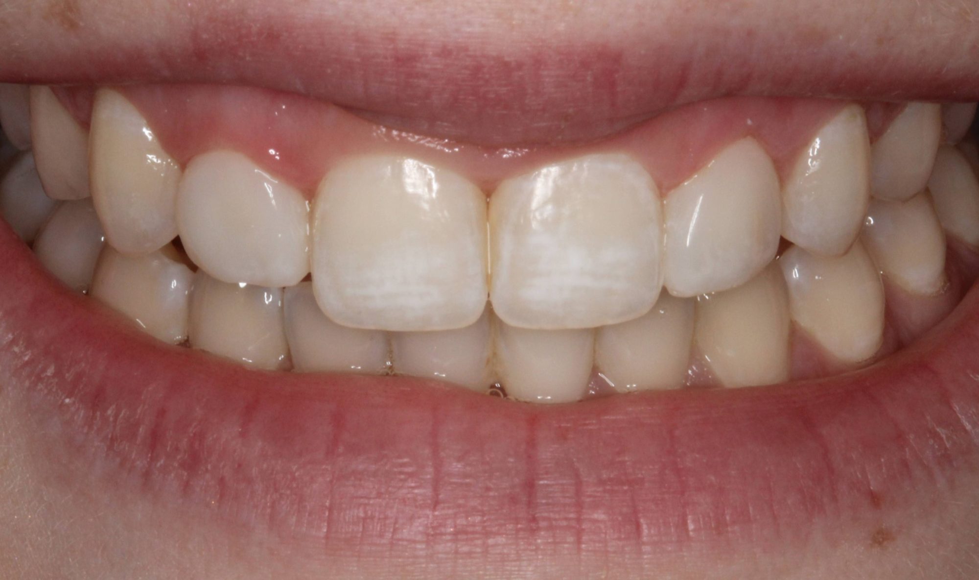 Sharp Dentistry | Dental Fillings, Implant Restorations and CBCT