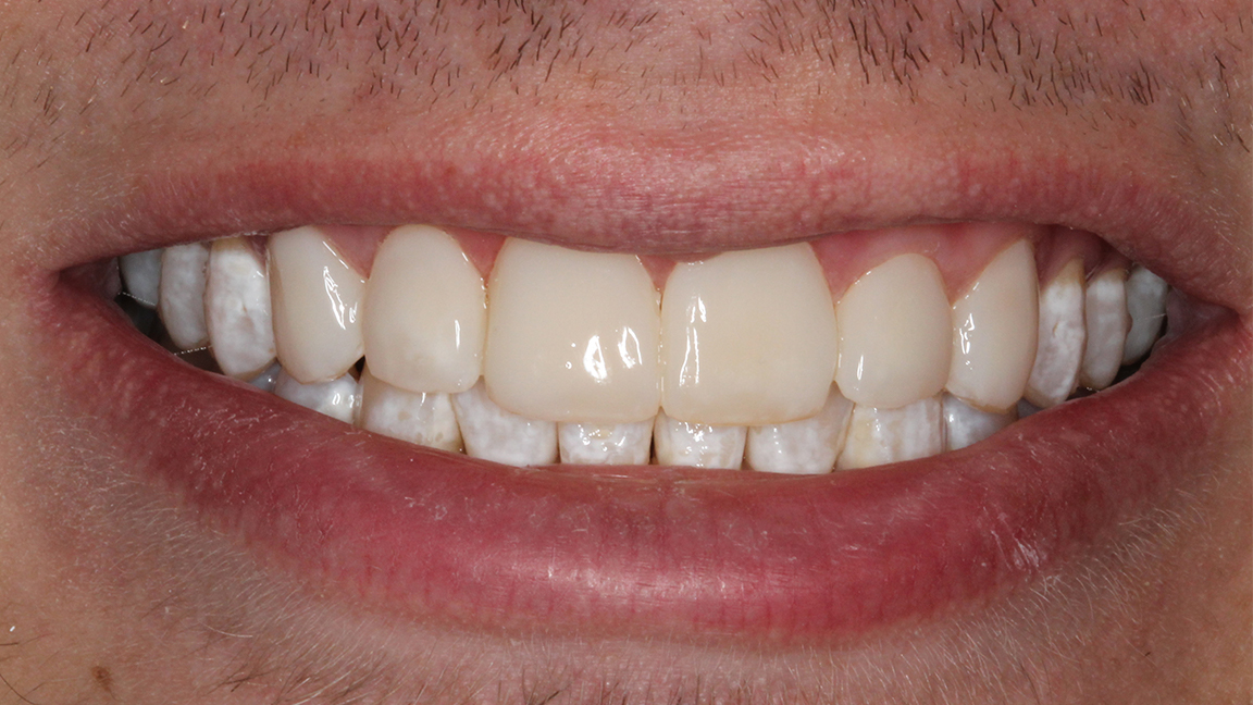 Sharp Dentistry | Sports Mouthguards, Dental Bridges and Pediatric Dentistry