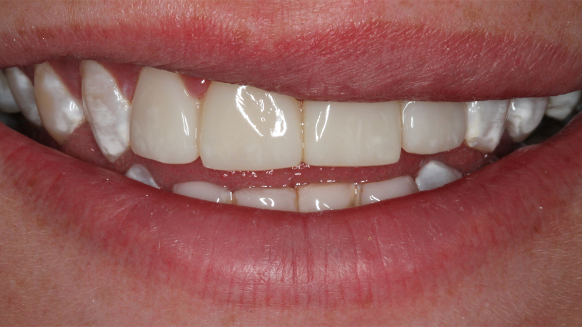 Sharp Dentistry | Oral Exams, Sports Mouthguards and Oral Cancer Screening