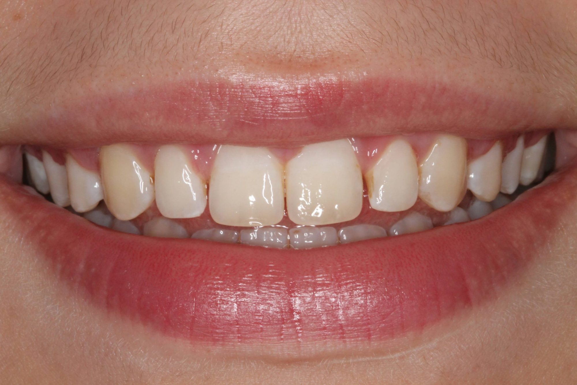 Sharp Dentistry | Snoring Appliances, Implant Restorations and Teeth Whitening