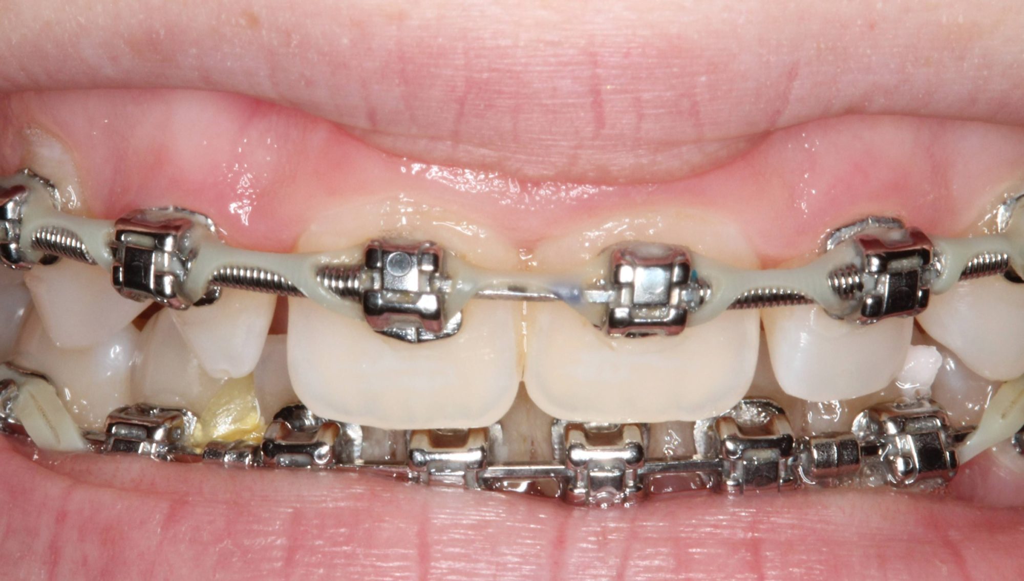 Sharp Dentistry | Sleep Apnea, Night Guards and Sedation Dentistry