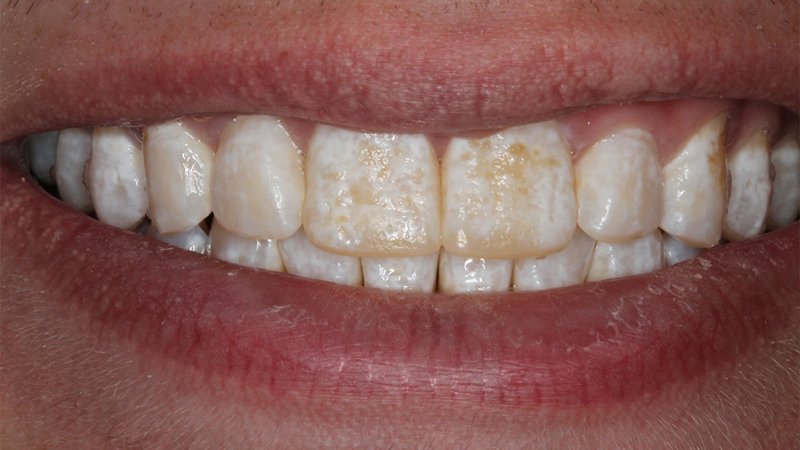 Sharp Dentistry | Dental Bridges, Intraoral Camera and Dentures