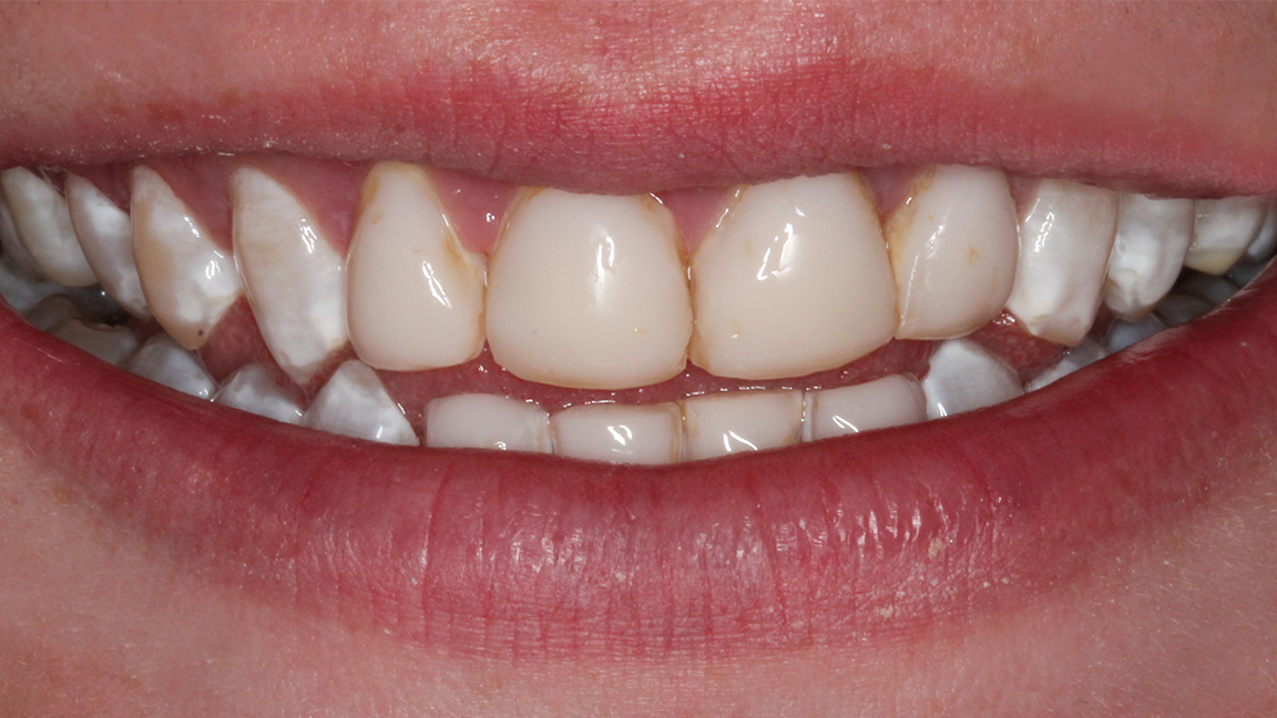 Sharp Dentistry | Crowns, Sports Mouthguards and All-on-6 reg