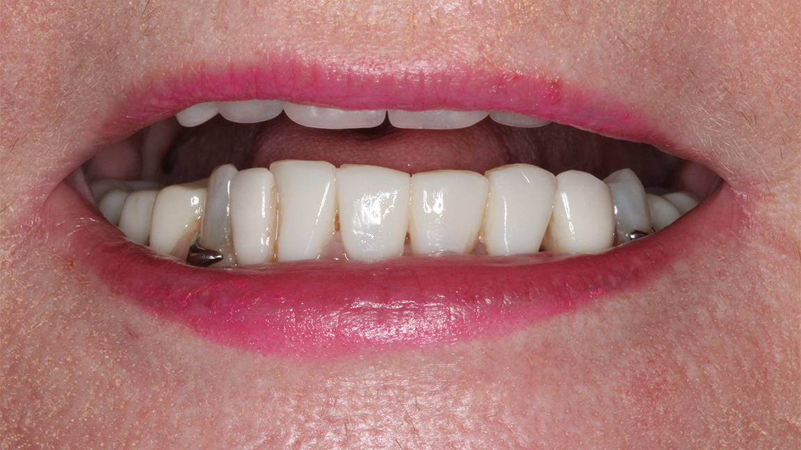 Sharp Dentistry | TMJ Disorders, Extractions and Fluoride Treatment