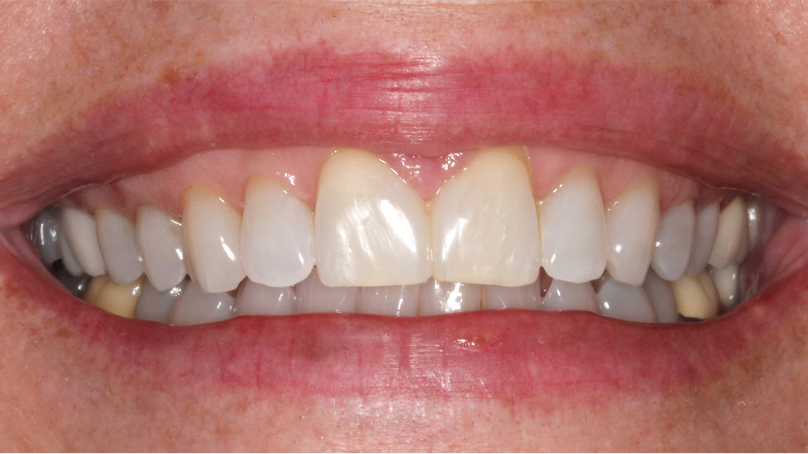 Sharp Dentistry | Implant Dentistry, Dental Lab and Preventative Program