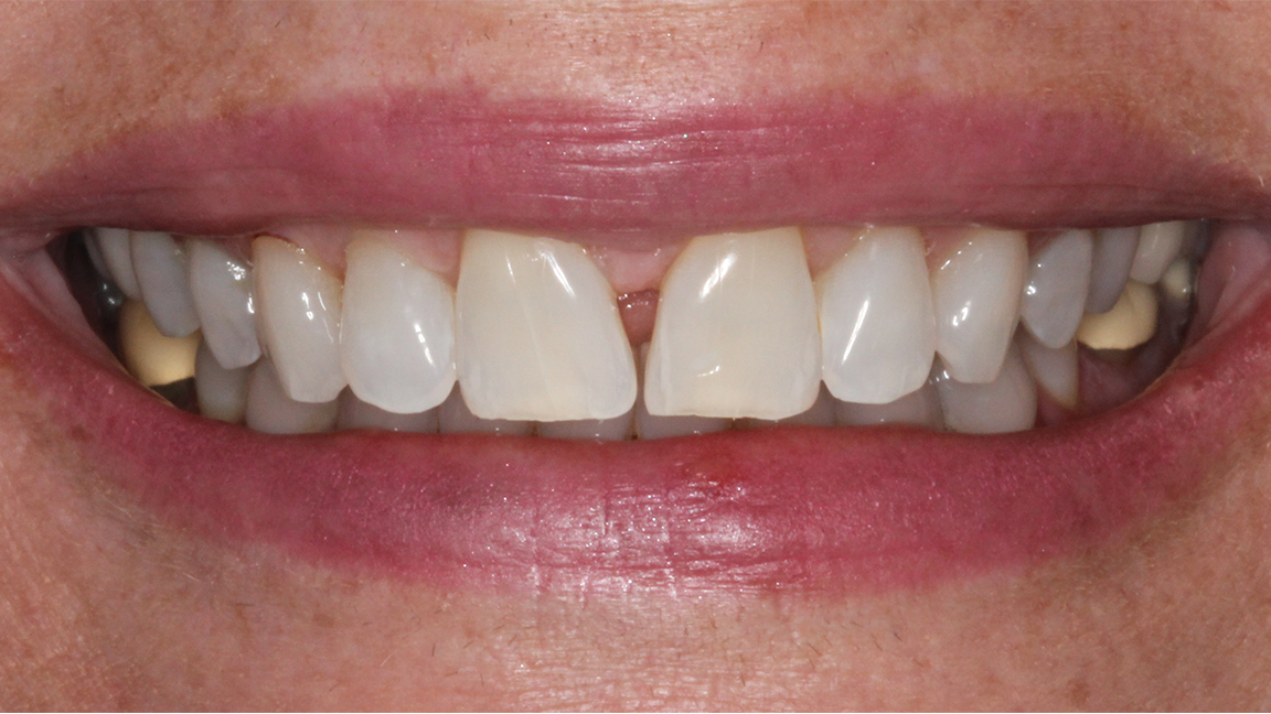 Sharp Dentistry | Night Guards, Snoring Appliances and Preventative Program