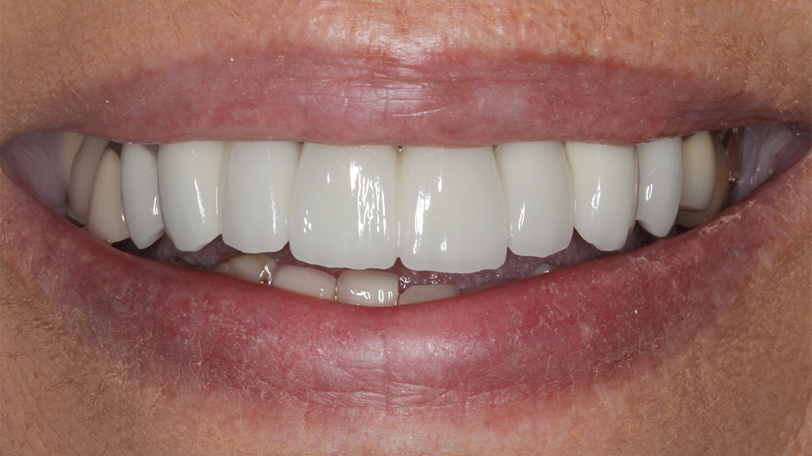 Sharp Dentistry | Dental Sealants, Dental Lab and Full Mouth Reconstruction