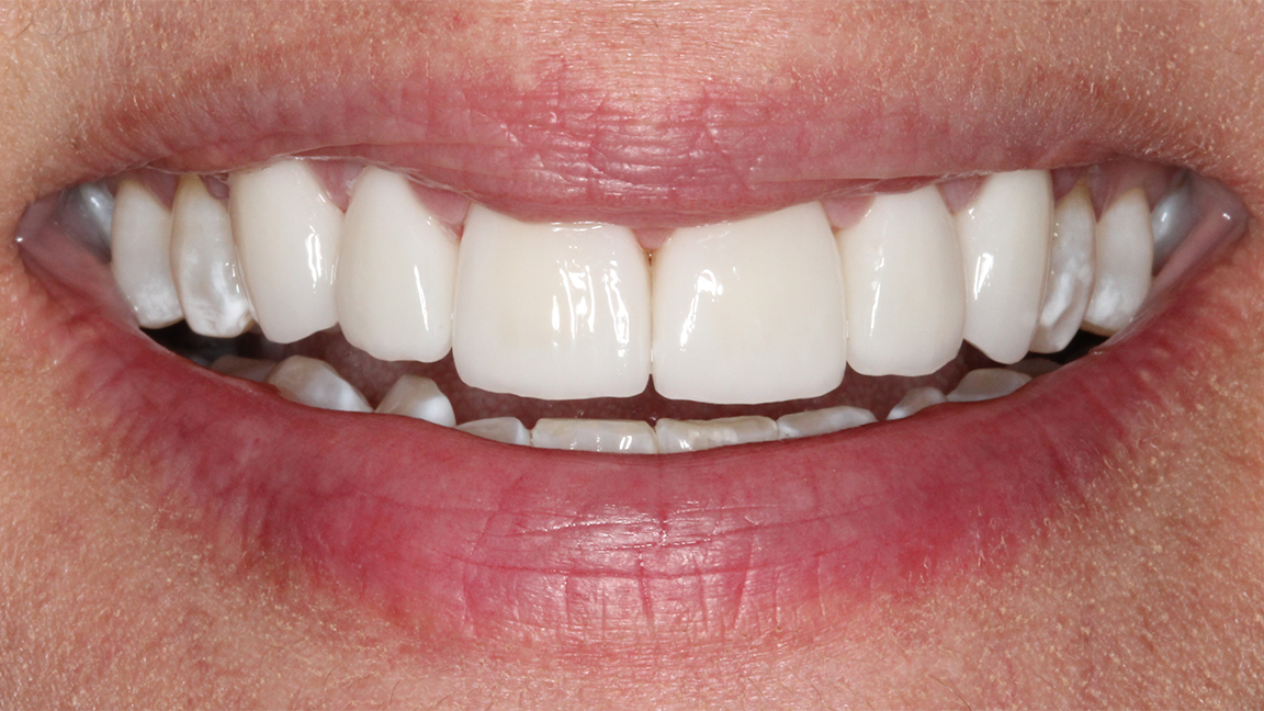 Sharp Dentistry | Crowns, Sedation Dentistry and Implant Dentistry