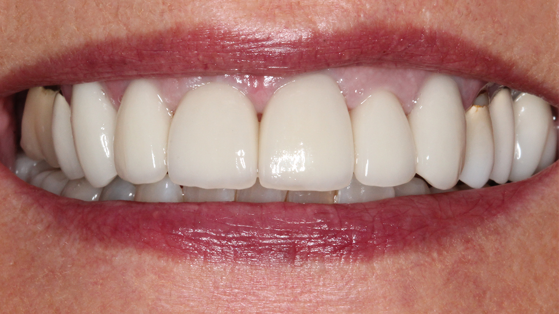 Sharp Dentistry | Dental Bridges, TMJ Disorders and Teeth Whitening