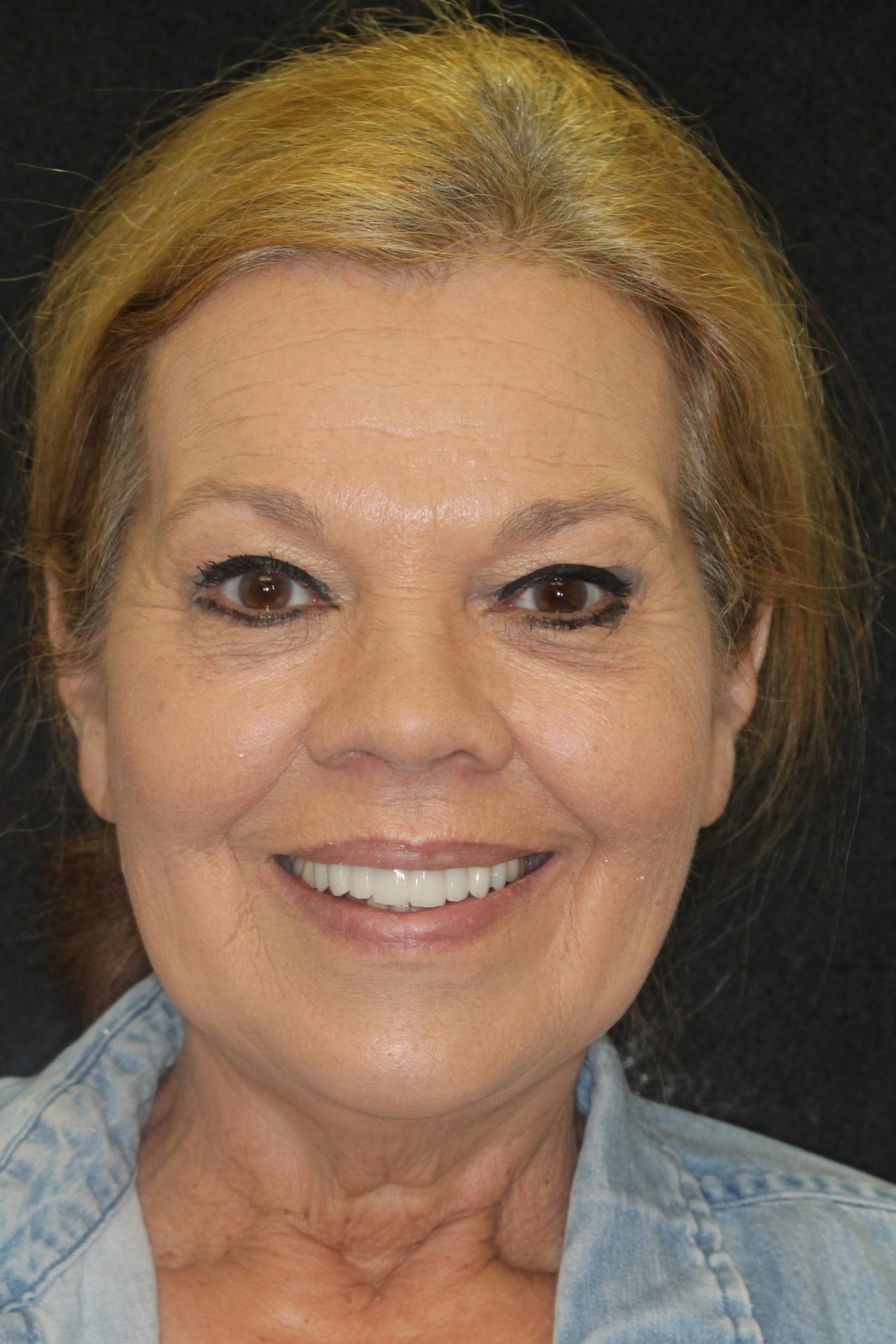 Sharp Dentistry | All-on-4®, Sedation Dentistry and Veneers