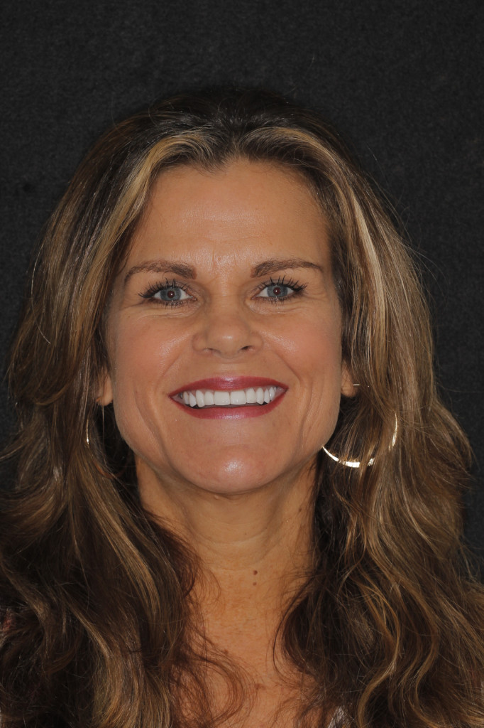 Sharp Dentistry | Dental Lab, Crowns and Implant Restorations