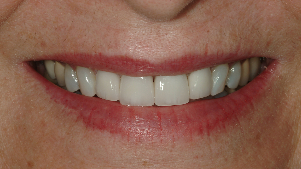 Sharp Dentistry | Periodontal Treatment, Sports Mouthguards and Oral Cancer Screening