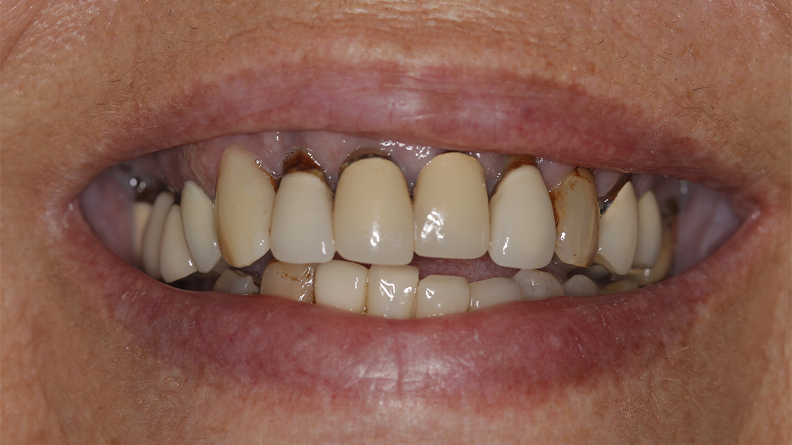 Sharp Dentistry | Extractions, Night Guards and Veneers