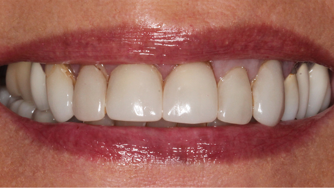 Sharp Dentistry | Oral Cancer Screening, Digital Impressions and Cosmetic Dentistry