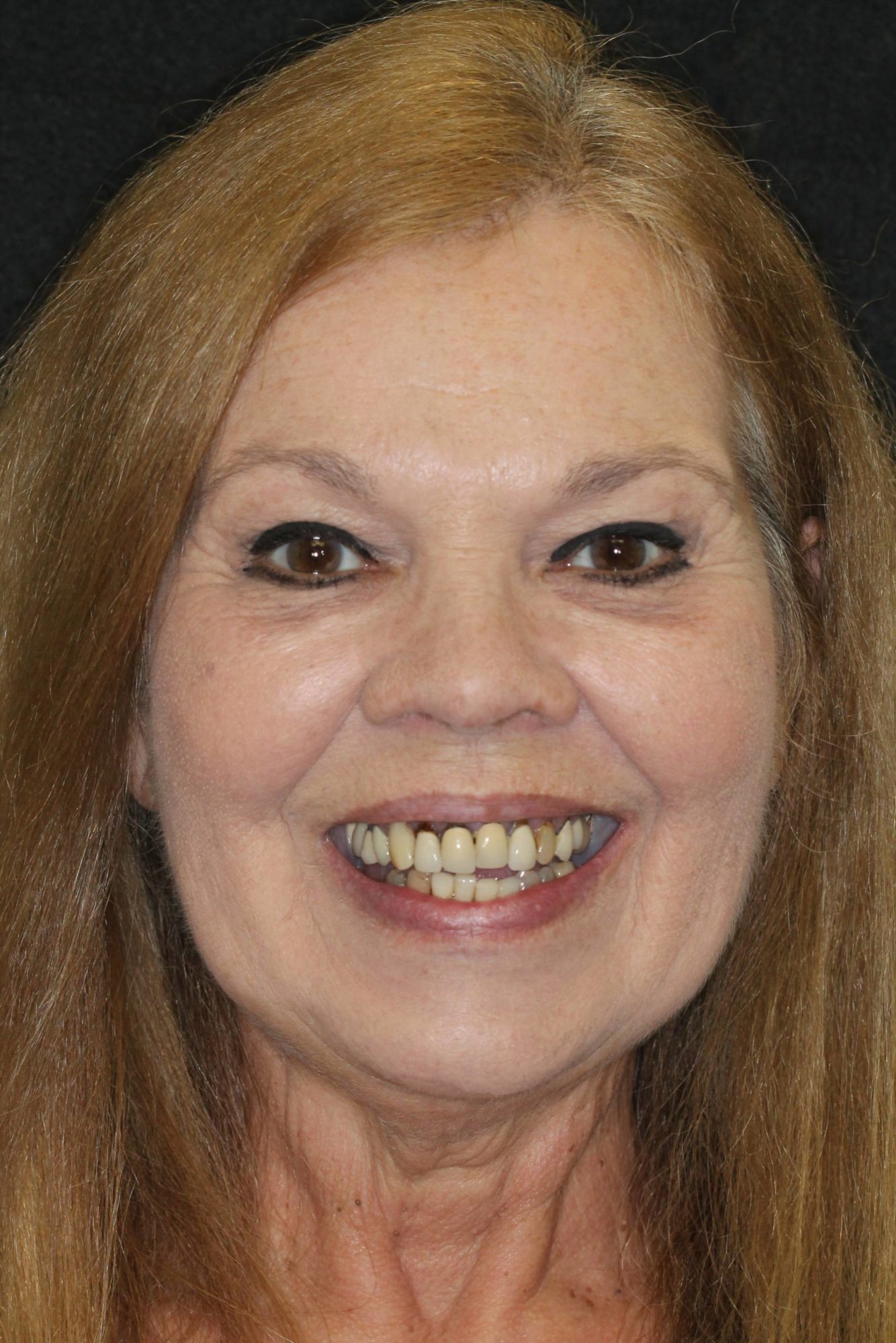 Sharp Dentistry | Ceramic Crowns, Dental Fillings and Dentures