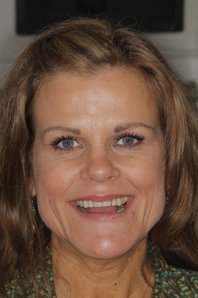 Sharp Dentistry | Ceramic Crowns, Dentures and Implant Dentistry