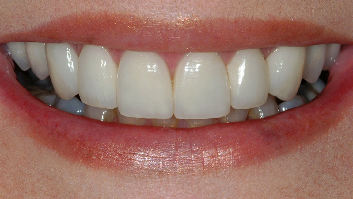 Sharp Dentistry | Preventative Program, Sedation Dentistry and All-on-6®