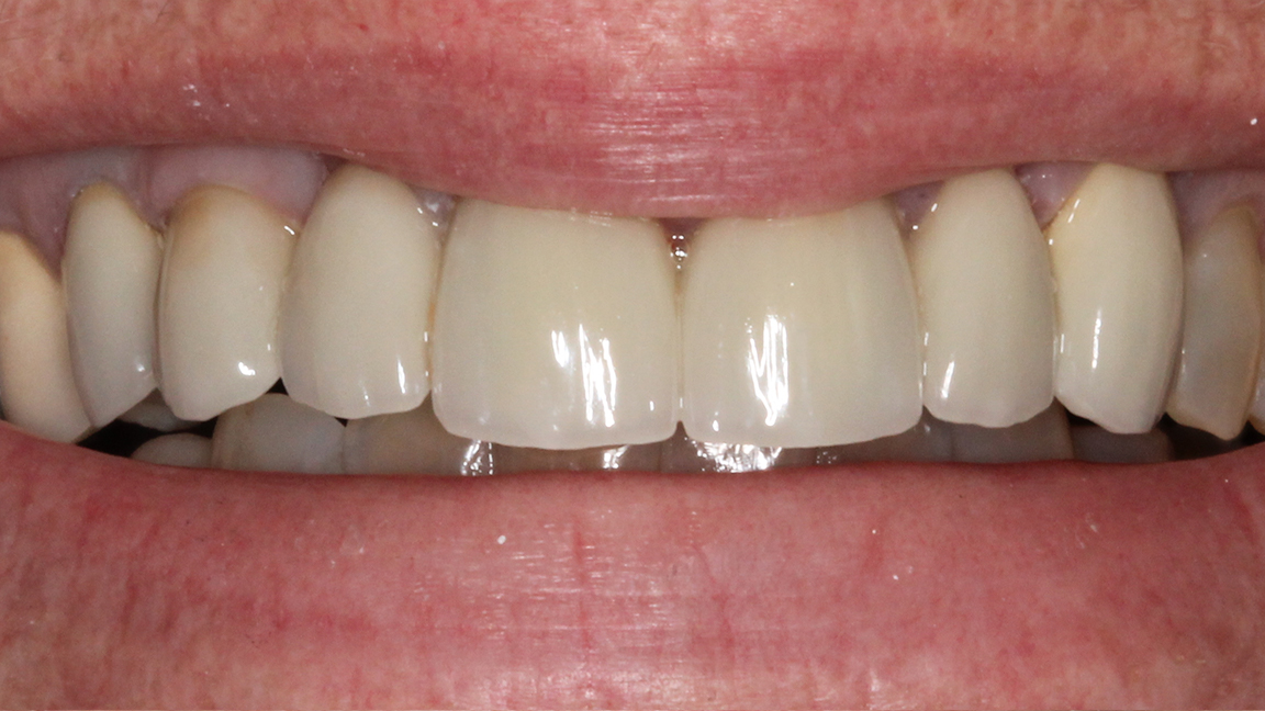 Sharp Dentistry | Cosmetic Dentistry, Dental Lab and Dental Fillings