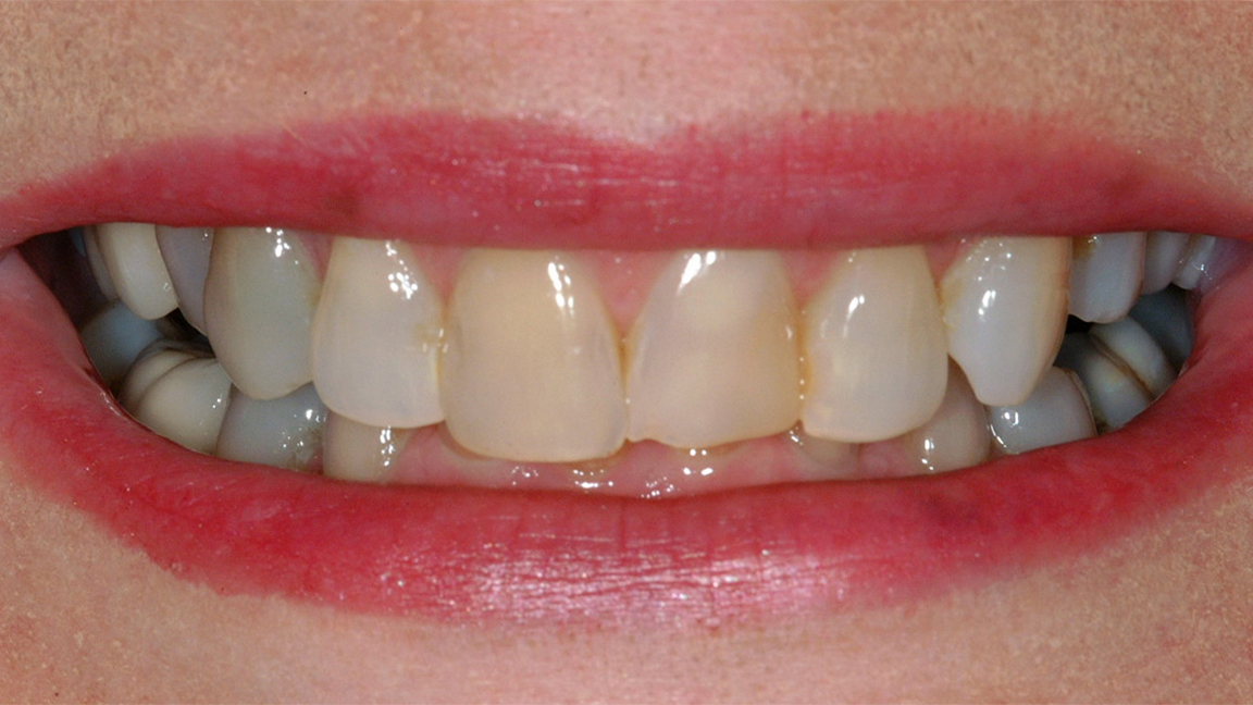 Sharp Dentistry | Night Guards, All-on-6® and Teeth Whitening