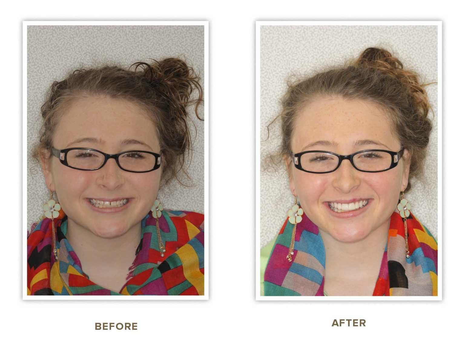 Sharp Dentistry | Digital Impressions, All-on-4 reg and TMJ Disorders