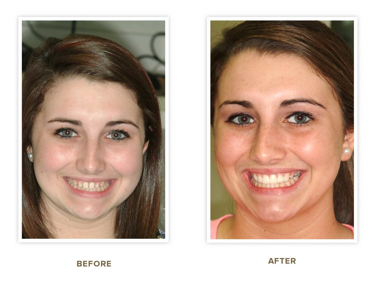 Sharp Dentistry | Full Mouth Reconstruction, Dental Fillings and Crowns