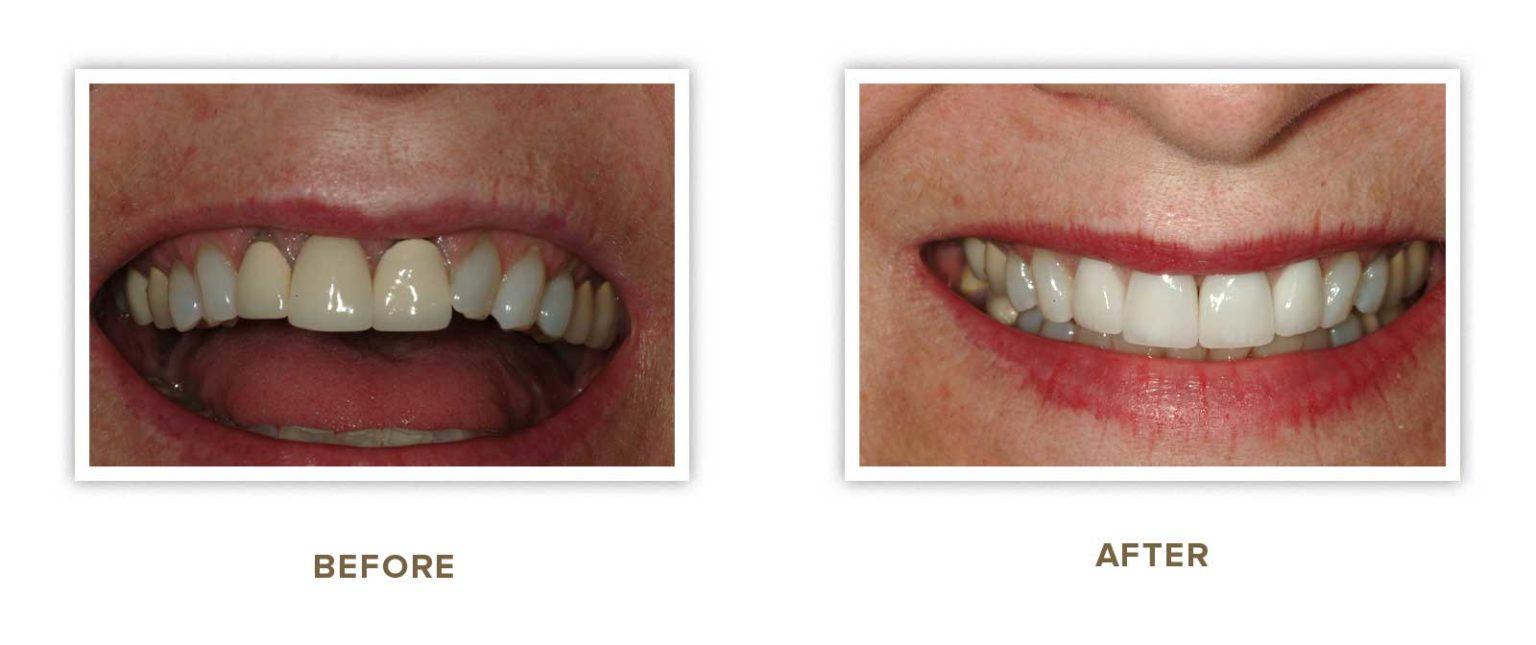 Sharp Dentistry | Full Mouth Reconstruction, All-on-4 reg and Sleep Apnea