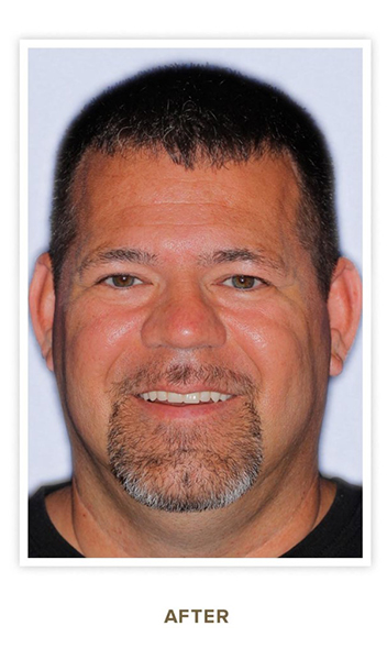 Sharp Dentistry | All-on-4®, Dental Lab and Sleep Apnea