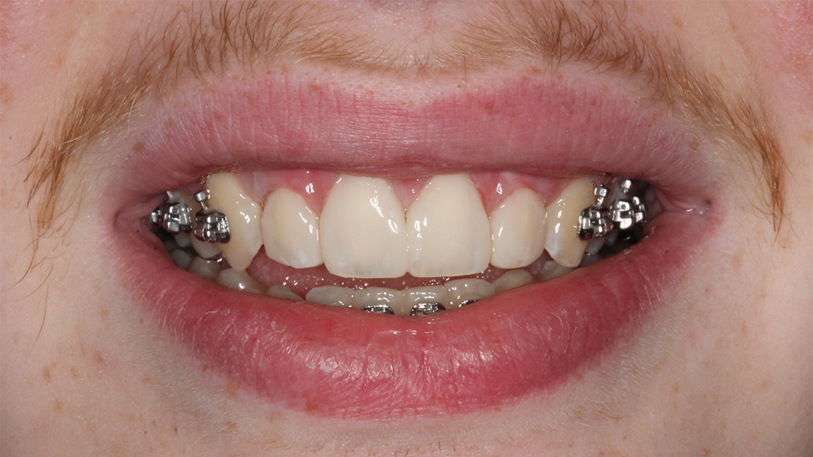 Sharp Dentistry | Inlays & Onlays, Extractions and All-on-6®