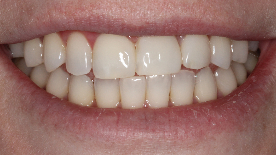 Sharp Dentistry | Emergency Treatment, Teeth Whitening and Intraoral Camera