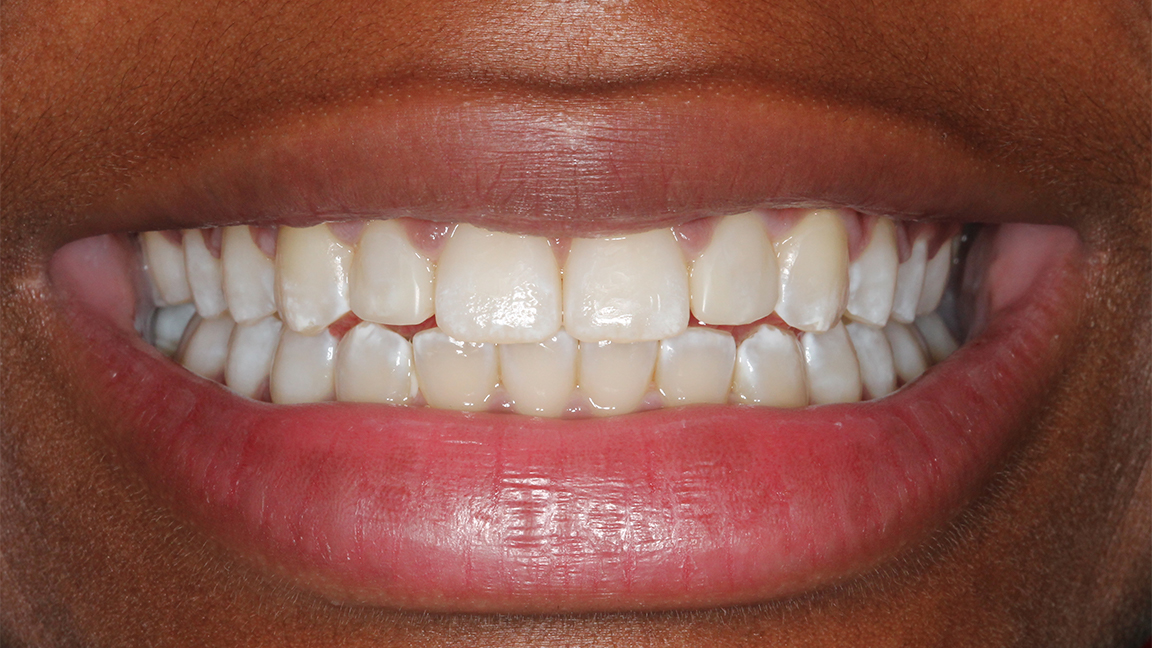 Sharp Dentistry | Periodontal Treatment, Dentures and Oral Exams