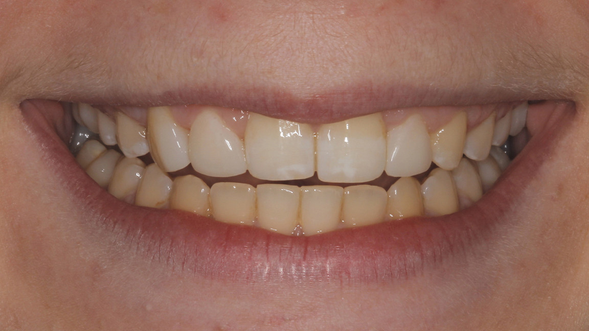 Sharp Dentistry | Dental Sealants, Sedation Dentistry and Oral Exams