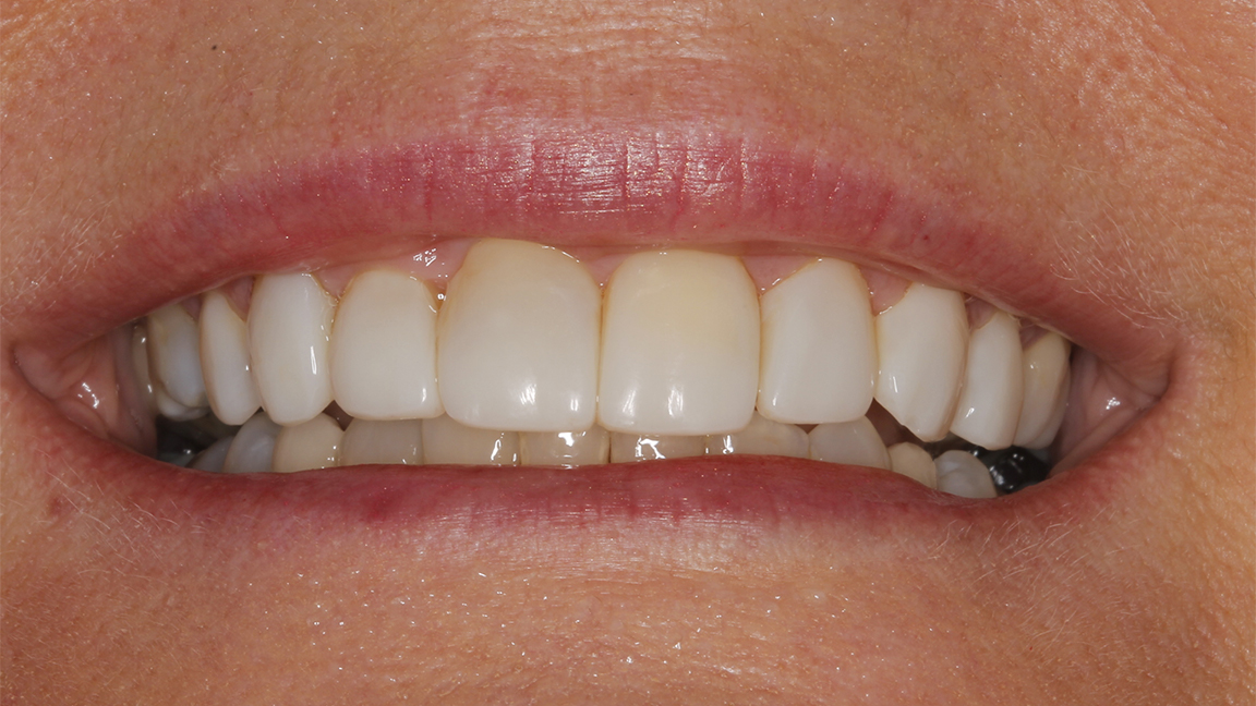 Sharp Dentistry | TMJ Disorders, CBCT and All-on-4®