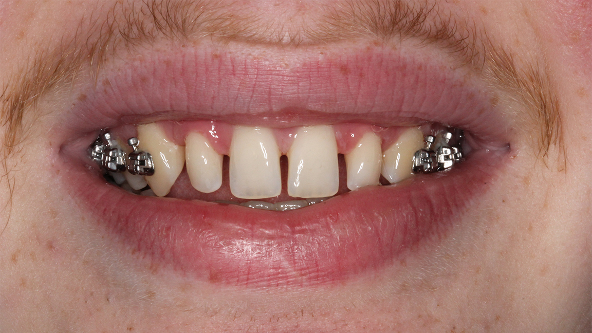 Sharp Dentistry | Digital Impressions, Extractions and Implant Restorations