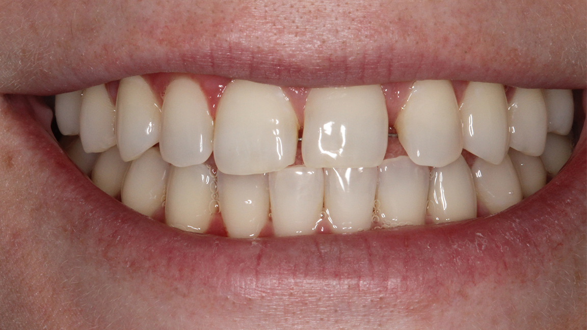 Sharp Dentistry | Implant Dentistry, Implant Restorations and Oral Cancer Screening