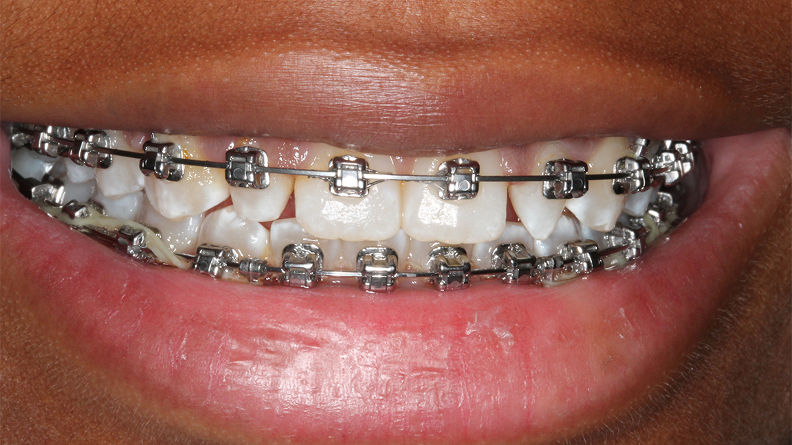 Sharp Dentistry | Intraoral Camera, Dental Cleanings and Teeth Whitening