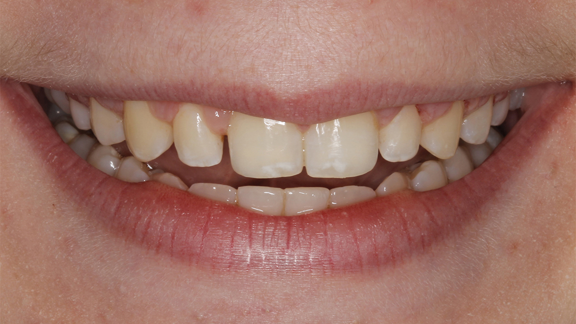 Sharp Dentistry | All-on-6®, Full Mouth Reconstruction and Inlays & Onlays