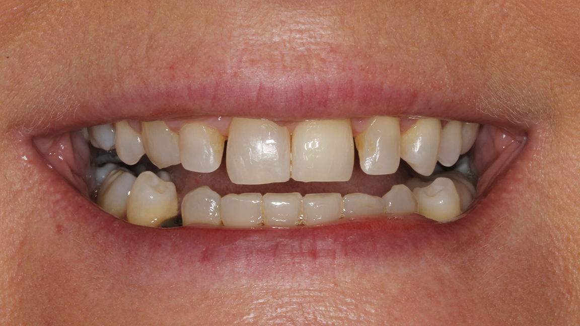 Sharp Dentistry | Dental Bridges, Dental Fillings and CBCT