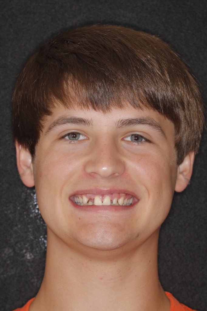 Sharp Dentistry | Night Guards, Emergency Treatment and Sleep Apnea