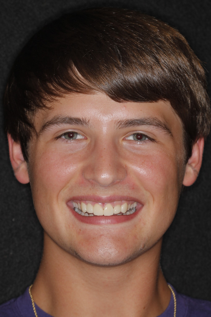 Sharp Dentistry | Implant Restorations, Implant Dentistry and Dentures