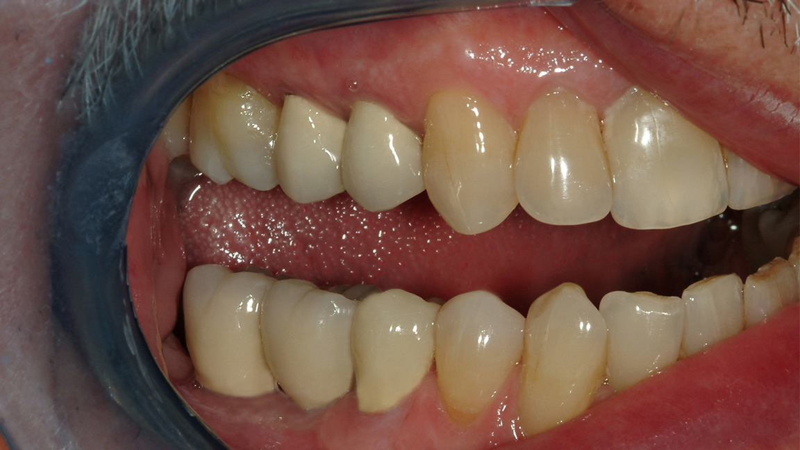 Sharp Dentistry | Dentures, Preventative Program and Dental Fillings