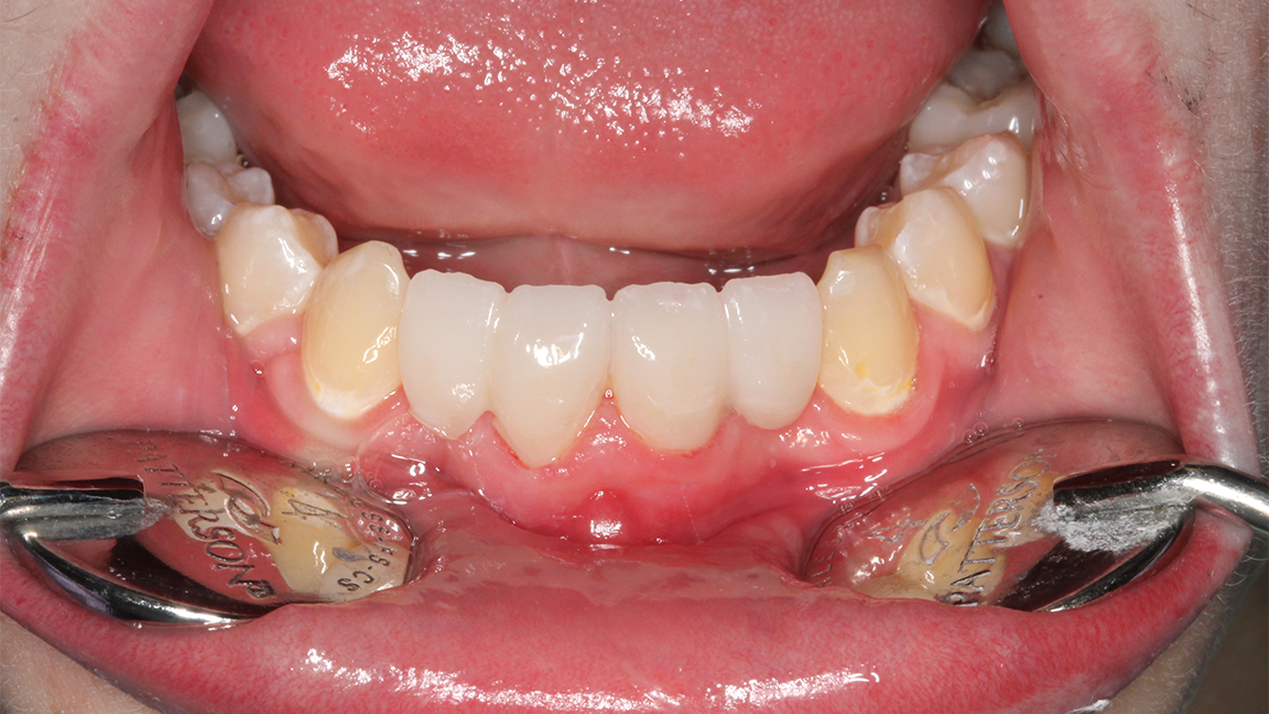 Sharp Dentistry | Intraoral Camera, CBCT and Oral Exams