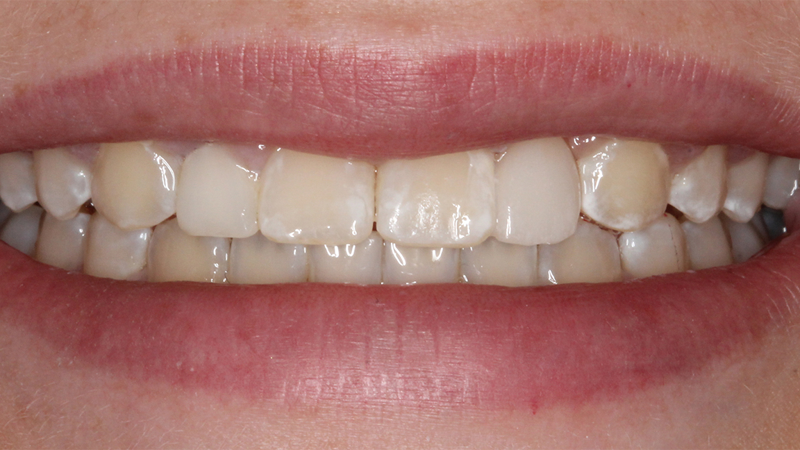 Sharp Dentistry | Implant Restorations, Extractions and Cosmetic Dentistry