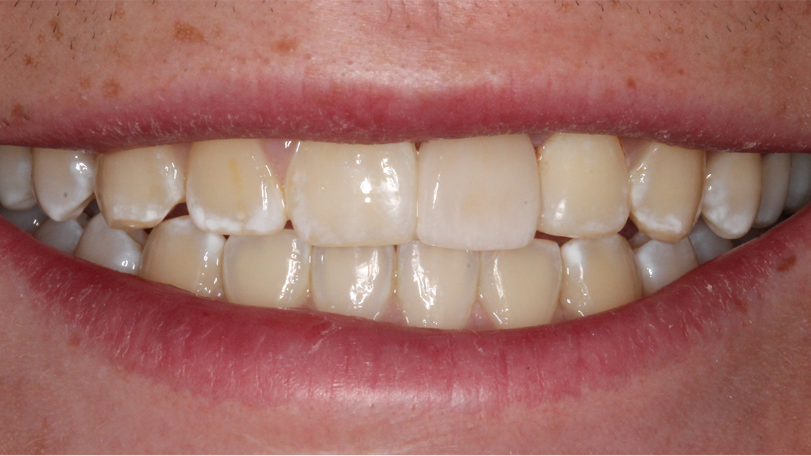 Sharp Dentistry | Sports Mouthguards, Dental Sealants and Extractions